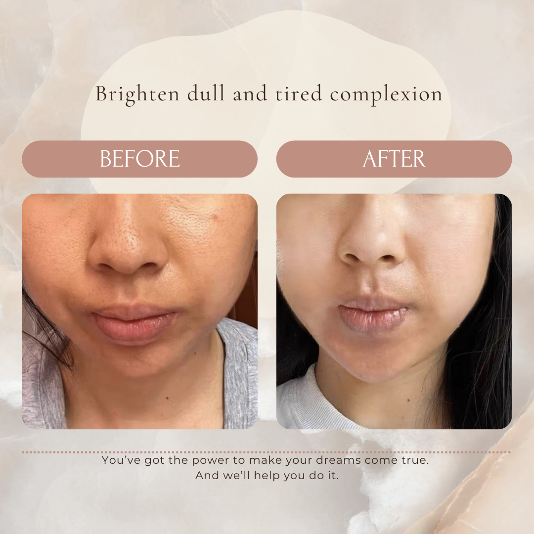 yurabi boost serum - ONS