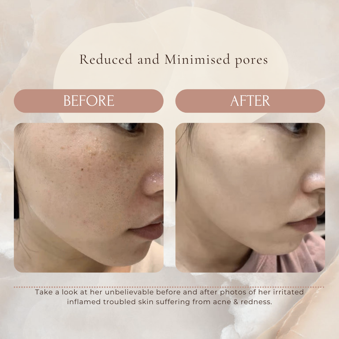 yurabi boost serum - ONS