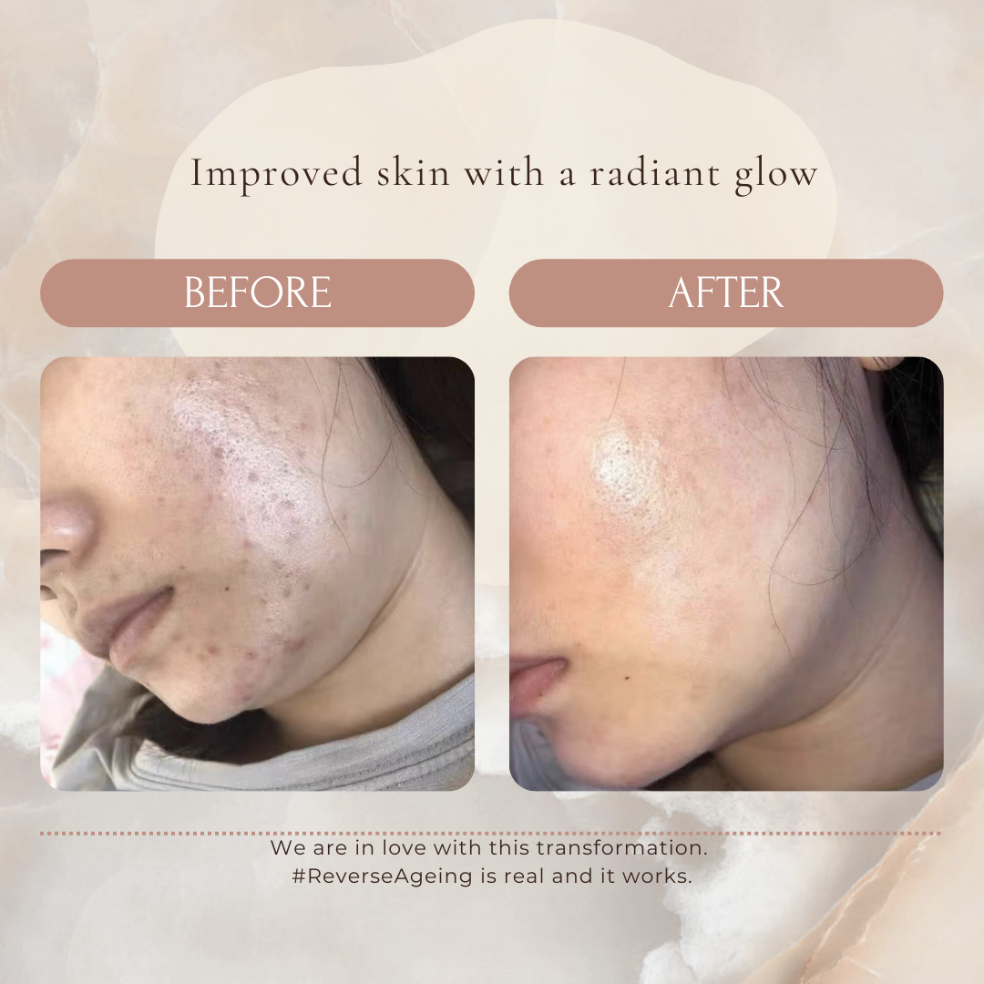 yurabi boost serum - ONS