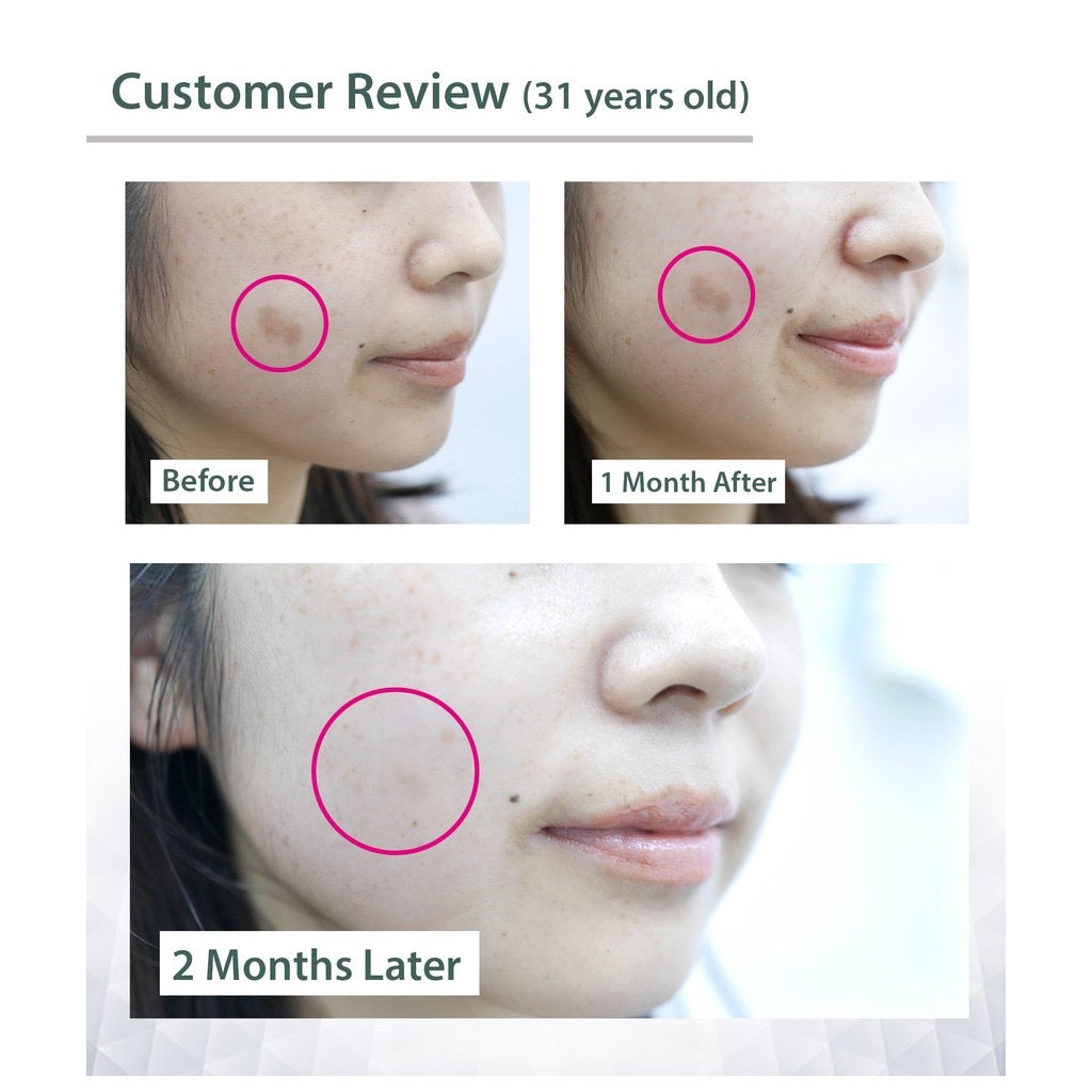 MSkin the White C Whitening Serum Lightens Dark Spots & Pigmentation (30ml) - GBS