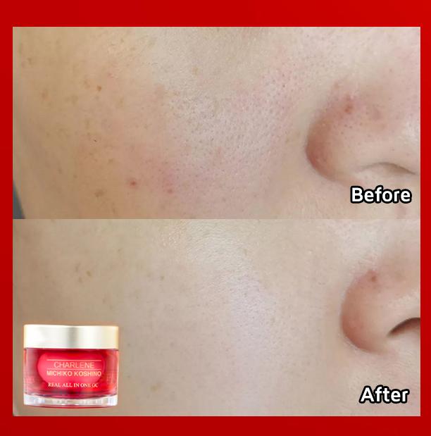 moisturizer for large pores and dry skin