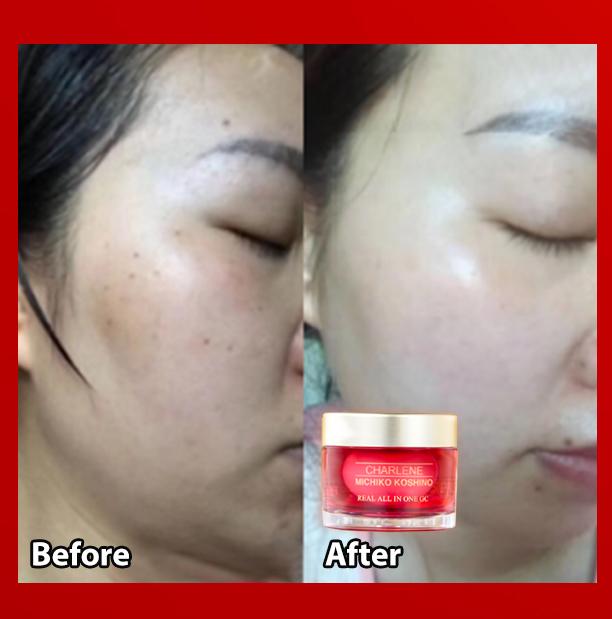 before after testimonial charlene all in one